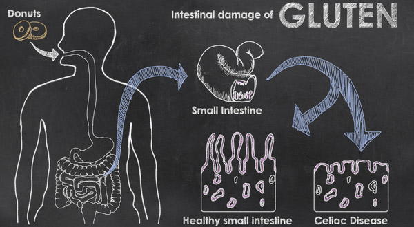 What happens to your body when you have Celiac Disease ...